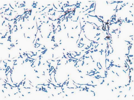 图 4骚动厄氏菌纯培养的镜下形态(革兰染色，24h)