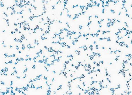 图 5骚动厄氏菌纯培养的镜下形态(革兰染色，72h)