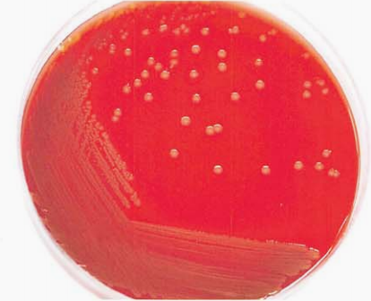 图 6骚动厄氏菌在血琼脂平板上菌落形态(18~24h)