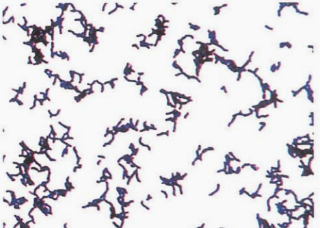 图 8溶血隐秘杆菌纯培养的镜下形态(革兰染色)