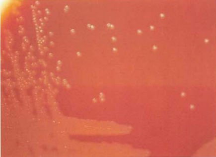 图 9溶血隐秘杆菌在血琼脂平板上的菌落特征(48h)