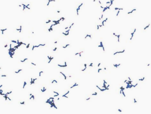 图 1化脓储珀菌纯培养的镜下形态(革兰染色)