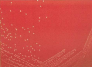 图 2 化脓储珀菌在血琼脂平板上的菌落特征(48h)