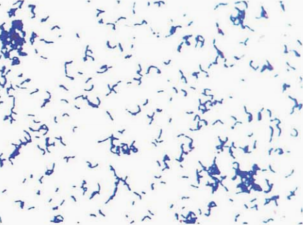 图 3猪红斑丹毒丝菌纯培养的镜下形态(革兰染色)