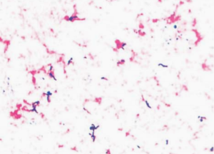 图 4猪红斑丹毒丝菌血培养标本的涂片(革兰染色)