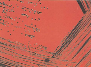 图 7猪红斑丹毒丝菌在亚碲酸钾血琼脂平板上的菌落特征(18~24h)