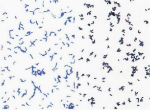 图 9猪红斑丹毒丝菌与假白喉棒杆菌镜下形态对比(革兰染色)左图为猪红斑丹毒丝菌;右图为假白喉棒杆菌