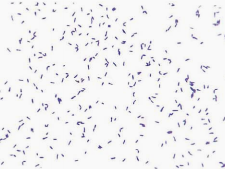 图 4白喉棒杆菌纯培养的镜下形态(革兰染色)