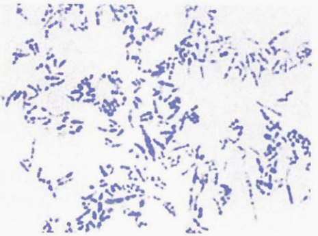 图 5白喉棒杆菌的异染颗粒(Neisser 染色)