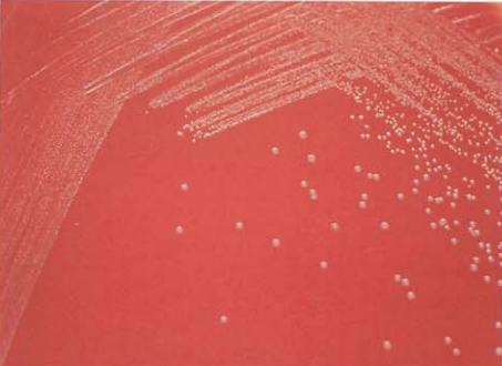 图 6白喉棒杆菌在血琼脂平板上的菌落特征(18~24h)