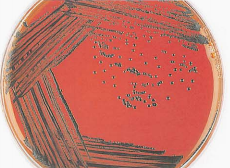 图 7白喉棒杆菌在亚碲酸钾血琼脂平板上的菌落特征(18~24h)