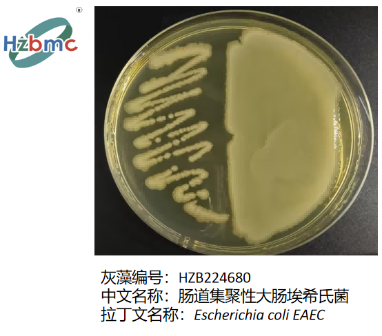 图3.肠道集聚性大肠埃希氏菌(Escherichia coli EAEC)在琼脂平板上的菌落形态