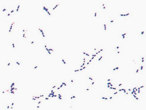 图 1 草绿色链球菌纯培养的镜下形态(革兰染色)