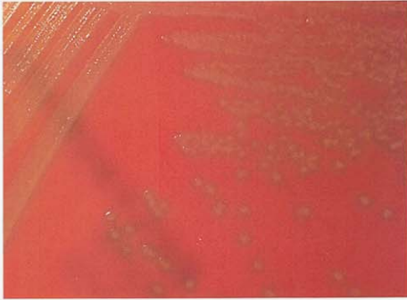 图 3 草绿色链球菌在血琼脂平板上的菌落特征(18~24h)