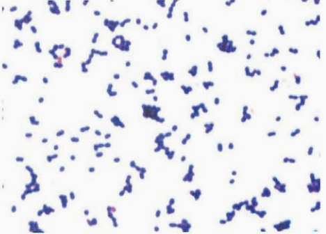 图 14 鹑鸡肠球菌纯培养的镜下形态(革兰染色)
