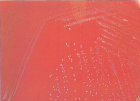 图 15 鹑鸡肠球菌在血琼脂平板上的菌落特征(18~24h)