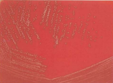 图 2肠膜无色藻菌在血琼脂平板上的菌落特征(18~24h)