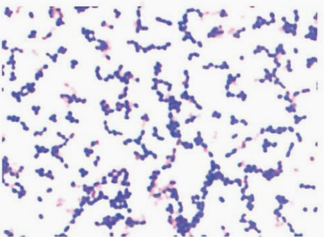 图 1粪肠球菌纯培养的镜下形态(革兰染色)