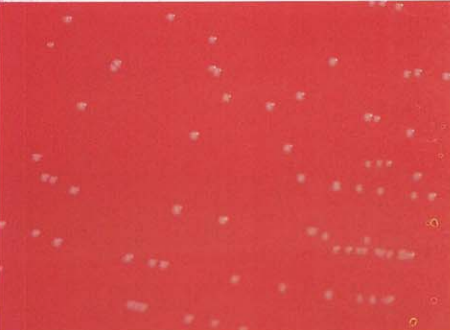 图 3粪肠球菌在血琼脂平板上的菌落特征(18~24h)