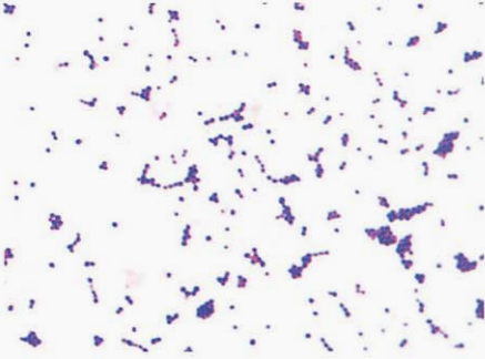 图 5 肯茨创伤球菌纯培养的镜下形态(革兰染色)