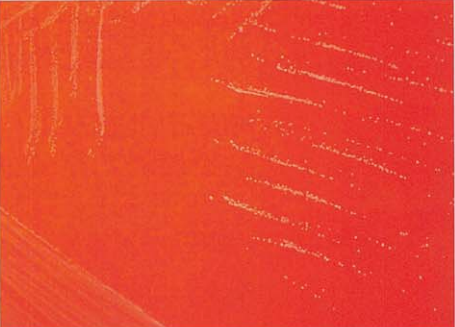 图 6 肯茨创伤球菌在血琼脂平板上的菌落特征(18~24h)