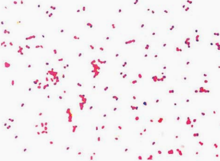 图 7 淋病奈瑟菌纯培养的镜下形态(革兰染色)