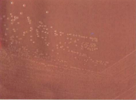 图 12 淋病奈瑟菌在巧克力琼脂平板上的菌落特征(18~24h)