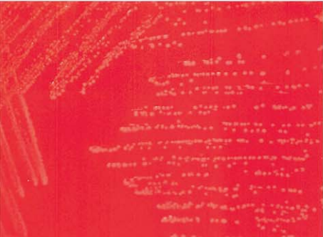 图 11 淋病奈瑟菌在血琼脂平板上的菌落特征(18~24h)