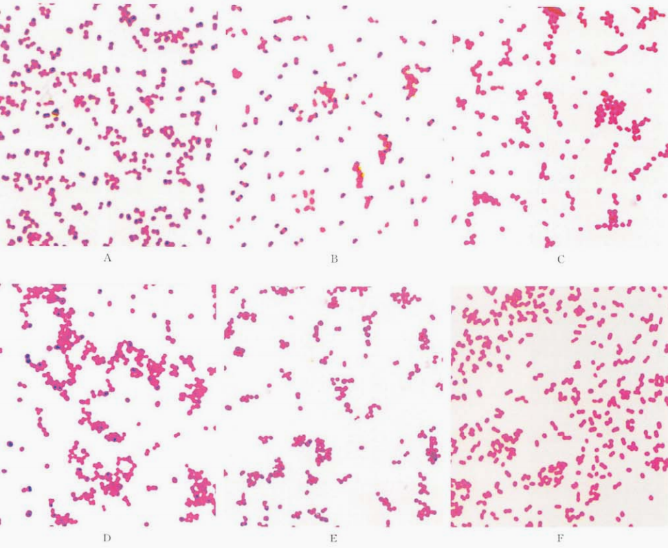 图 13 淋病奈瑟菌与其他相似菌的鉴别A.脑膜炎奈瑟菌:B.淋病奈瑟菌:C.奥斯陆莫拉菌:D.卡他莫拉菌:E鲍曼不动杆菌:F.洛菲不动杆菌