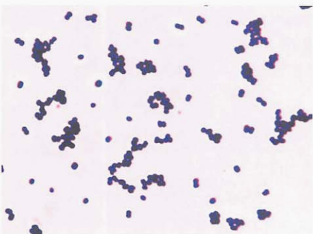 图 1绿色气球菌纯培养的镜下形态(革兰染色)