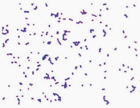 图 5麻疹孪生球菌纯培养镜下形态(革兰染色)