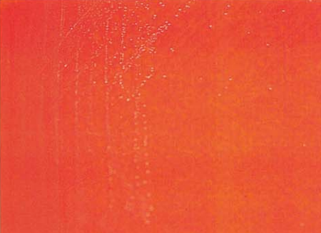 图 7 麻疹孪生球菌在血琼脂平板上的菌落特征(18~24h)