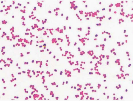 图 1脑膜炎奈瑟菌纯培养的镜下形态(革兰染色)