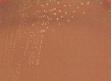 图 6脑膜炎奈瑟菌在巧克力琼脂平板上菌落特征(18~24h)