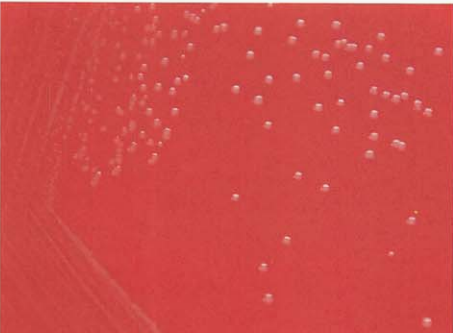 图 5脑膜炎奈瑟菌在血琼脂平板上菌落特征(18~24h)