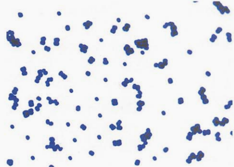 图 7黏液罗氏菌纯培养的镜下形态(革兰染色)