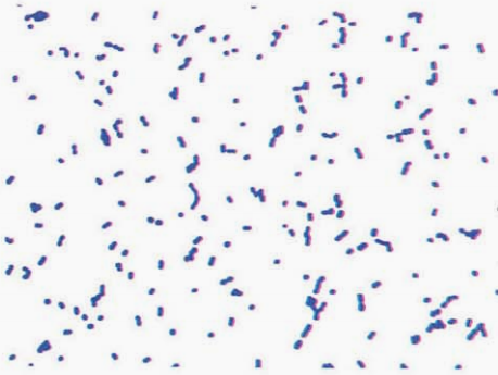 图 1 毗邻颗粒链菌纯培养镜下形态(革兰染色)