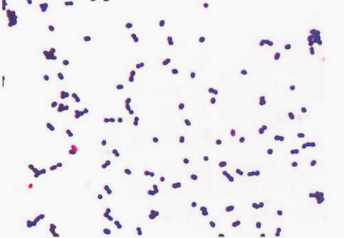 图 10 铅黄肠球菌纯培养的镜下形态(革兰染色)