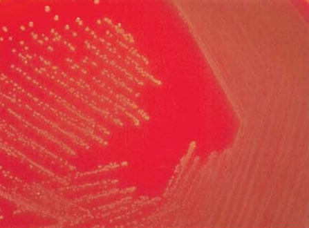 图 11铅黄肠球菌在血琼脂平板上的菌落特征(18~24h)