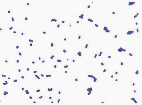 图 12 铅黄肠球菌与鹑鸡肠球菌的镜下形态左图为铅黄肠球菌:右图为鹑鸡肠球菌