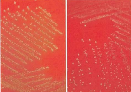 图  13 铅黄肠球菌与鹑鸡肠球菌在血琼脂平板上的菌落特征左图为铅黄肠球菌:右图为鹑鸡肠球菌