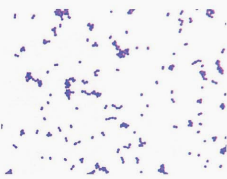 图 3缺陷乏养菌纯培养的镜下形态(革兰染色)