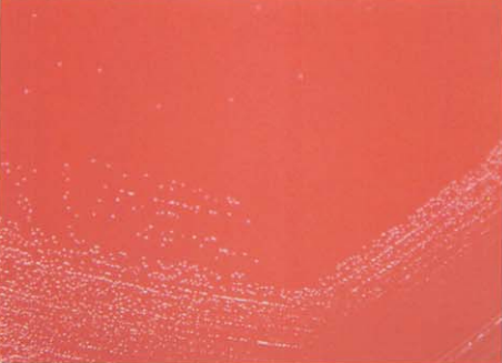 图 9 乳酸乳球菌在血琼脂平板上的菌落特征(18~24h)