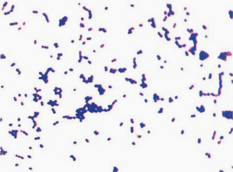 图 3溶血孪生球菌纯培养镜下形态(革兰染色)