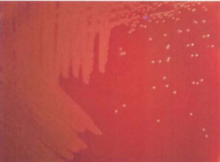 图 4 溶血李生球菌在血琼脂平板上的菌落特征(18~24h)