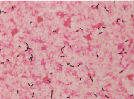 图 7 屎肠球菌血培养标本的涂片(革兰染色)