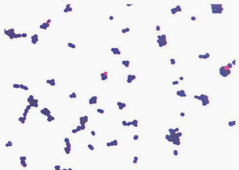 图 6 屎肠球菌纯培养的镜下形态(革兰染色)