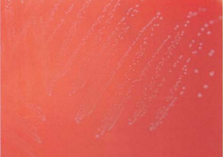 图 8屎肠球菌在血琼脂平板上的菌落特征(18~24h)