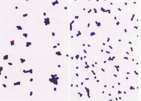 图 9屎肠球菌与粪肠球菌的镜下形态左图为屎肠球菌,右图为粪肠球菌