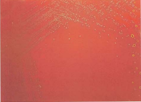 图 7 咽峡炎链球菌在血琼脂平板上的菌落特征(18~24h)